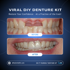 DIY Denture Kit (Partial Denture)