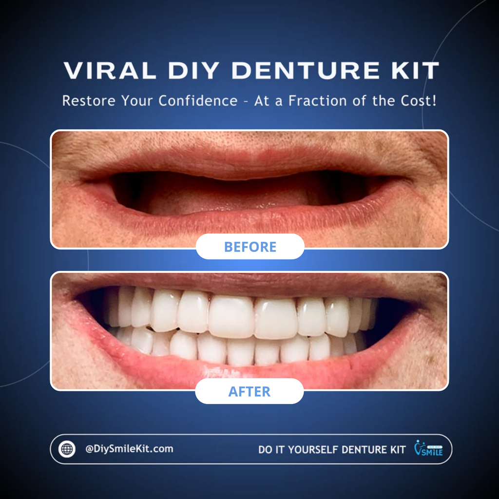 DIY Denture Kit (Upper + Lower - FULL Denture)