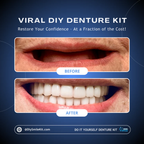 DIY Denture Kit (Upper + Lower - FULL Denture)