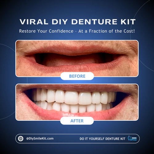 DIY Denture Kit (Upper + Lower - FULL Denture)